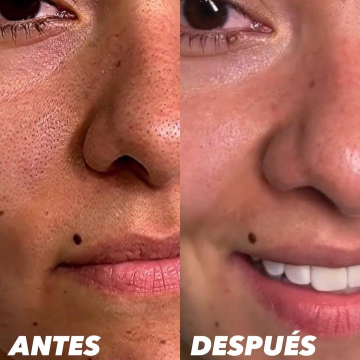 Antes y después del uso de la mascarilla exfoliante cambios inmediatos.